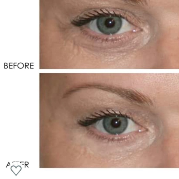 New Dermelect Revitalite Eyelid and Dark Circle Corrector - Picture 3 of 16